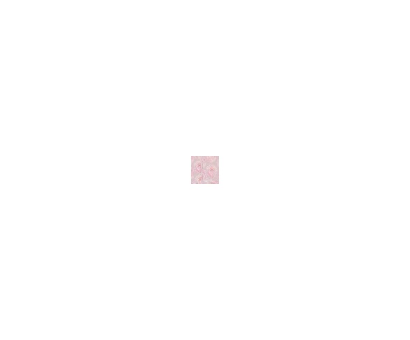 Halo Innovations SleepSack Wearable Blanket Micro Fleece - Pink Medallion S