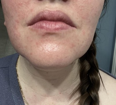 Guest review image 1 of 1, zoom in