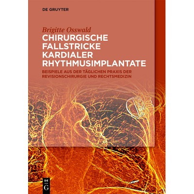 Chirurgische Fallstricke Kardialer Rhythmusimplantate - by  Brigitte Osswald (Paperback)