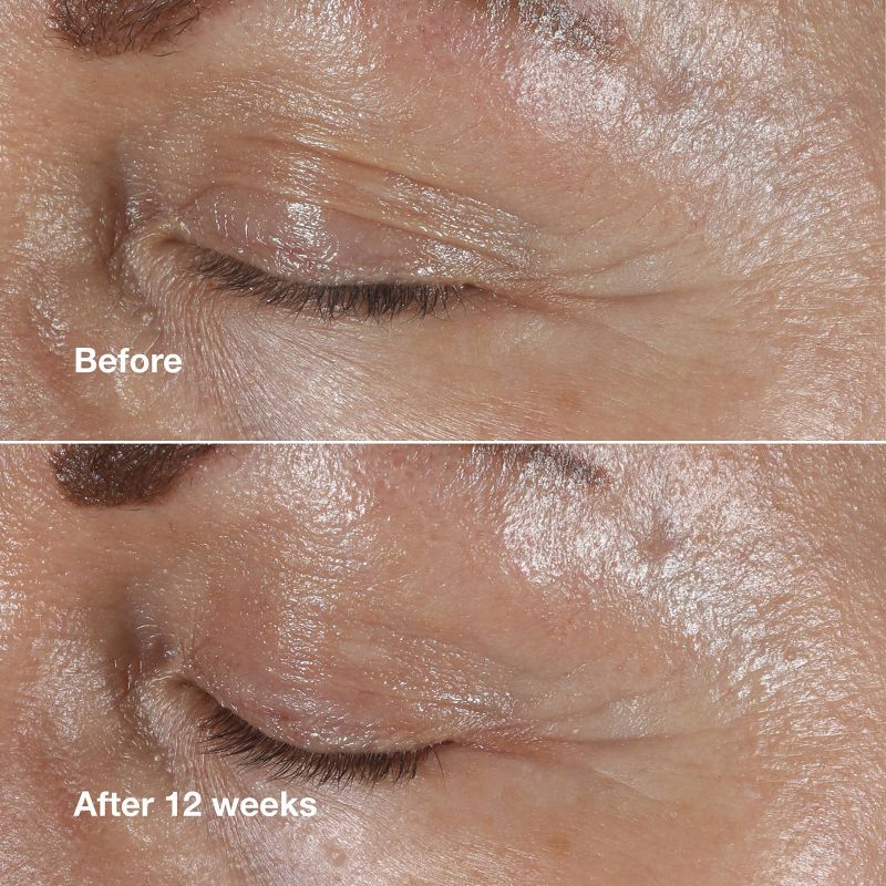 Clinique Smart Clinical Repair Wrinkle Correcting Eye Cream - 0.5oz - Ulta Beauty, 6 of 11