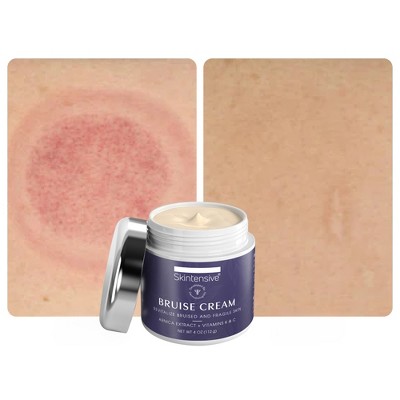 SKINTENSIVE Arnica Bruise Cream, 4 Oz, for Thin Skin, Moisturizing, Vitamin K C and E, Skin Renewal