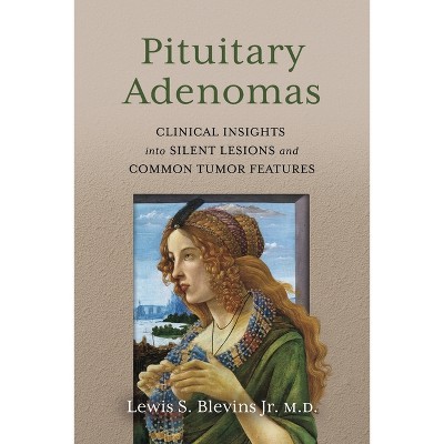 Pituitary Adenomas - by  Lewis S Blevins (Paperback)