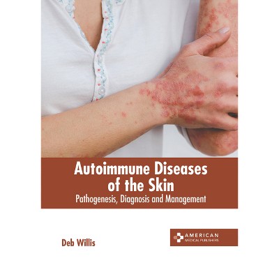Autoimmune Diseases of the Skin: Pathogenesis, Diagnosis and Management - by  Deb Willis (Hardcover)