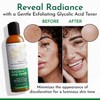 Tree To Tub Glycolic Acid Toner for Face Witch Hazel for Smooth Skin - Minimizes Appearance of Fine Lines - Vegan Exfoliating Toner for Women & Men - 2 of 4