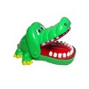 Crocodile Dentist Game - 4 of 4