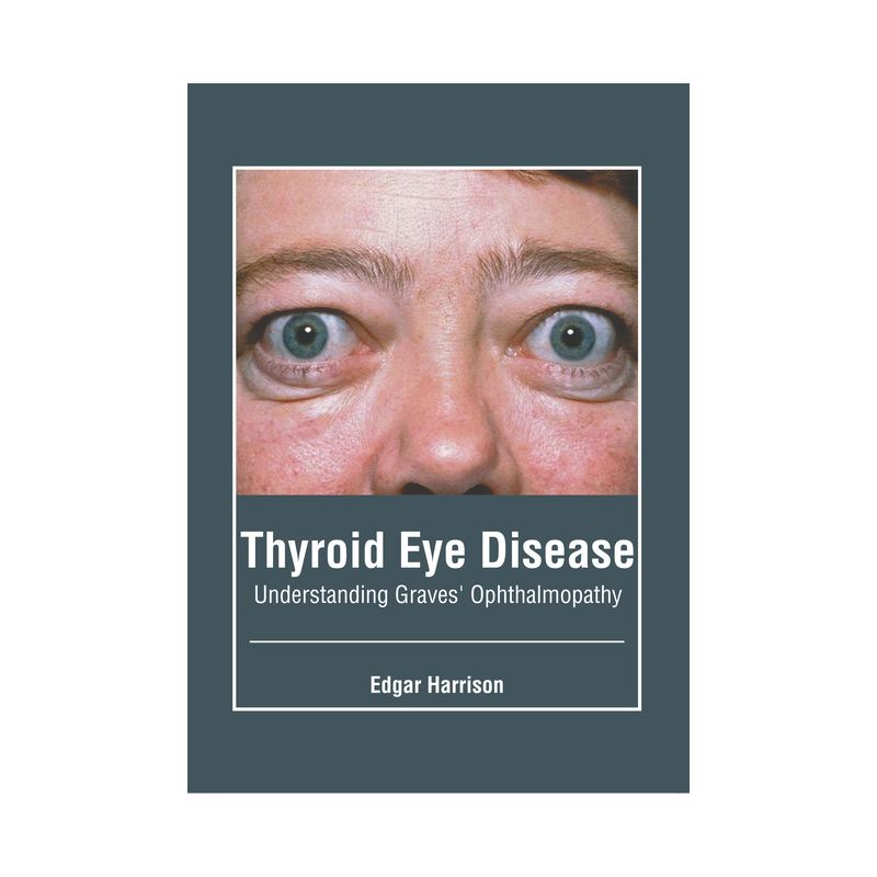 Thyroid Eye Disease: Understanding Graves' Ophthalmopathy - by  Edgar Harrison (Hardcover), 1 of 2