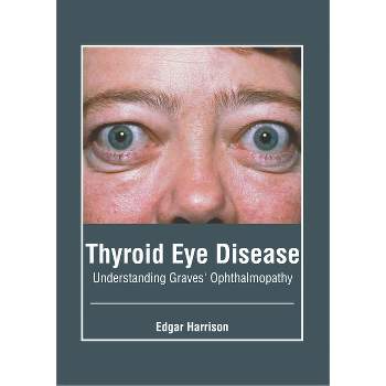Thyroid Eye Disease: Understanding Graves' Ophthalmopathy - by  Edgar Harrison (Hardcover)