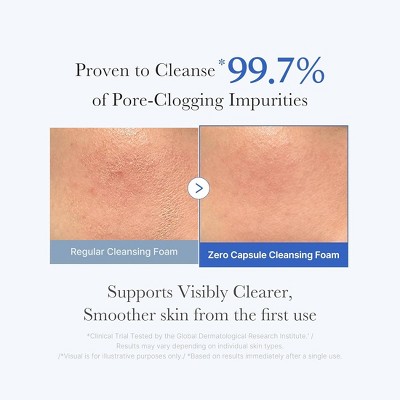medicube Zero Pore Clearing Capsule Cleansing Foam Korean Skincare: Contains PHA, Salicylic Acid, Cream Form, Normal/Oily Skin