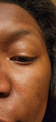 Guest review image 1 of 2, zoom in