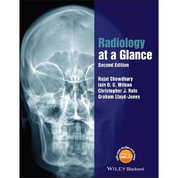 Radiology at a Glance - (At a Glance) 2nd Edition by  Rajat Chowdhury & Iain Wilson & Christopher Rofe & Graham Lloyd-Jones (Paperback)