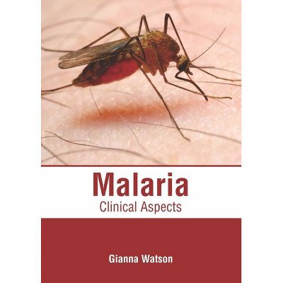 Malaria: Clinical Aspects - by  Gianna Watson (Hardcover)