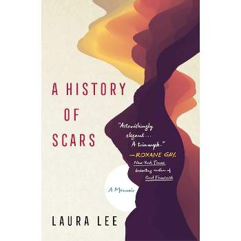 A History of Scars - by  Laura Lee (Paperback)