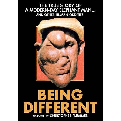 Being Different (DVD)(2017)