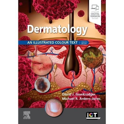 Dermatology - (Illustrated Colour Text) 7th Edition by  David Gawkrodger (Paperback)