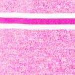 aster