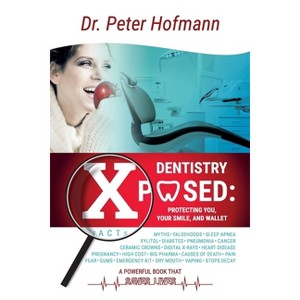 Dentistry Xposed - Large Print by  Peter Hofmann (Paperback) - 1 of 1