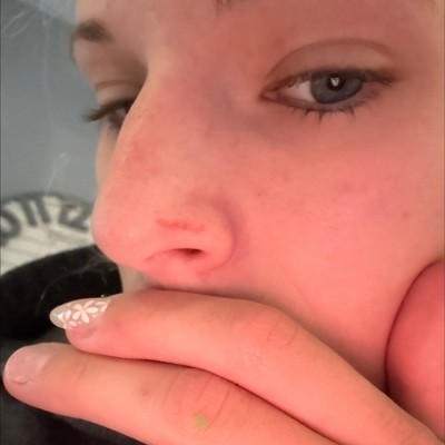 Guest review image 1 of 2, zoom in