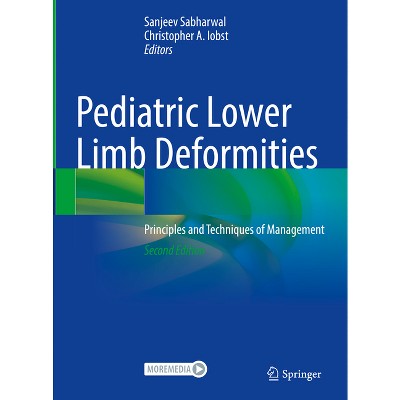 Pediatric Lower Limb Deformities - 2nd Edition by  Sanjeev Sabharwal & Christopher A Iobst (Hardcover)