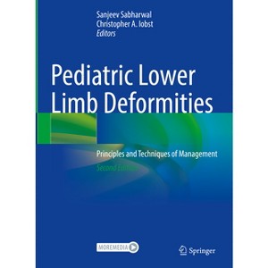 Pediatric Lower Limb Deformities - 2nd Edition by  Sanjeev Sabharwal & Christopher A Iobst (Hardcover) - 1 of 1