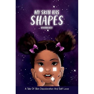 My Skin Has Shapes - by  Rayna Best (Hardcover)