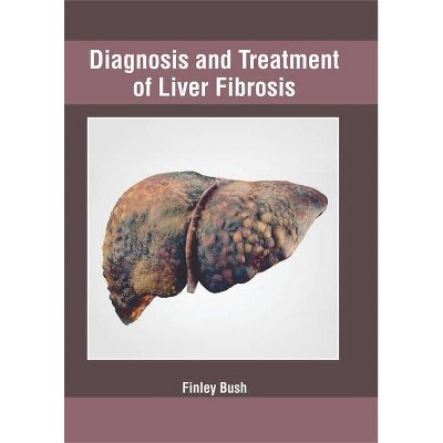 Diagnosis and Treatment of Liver Fibrosis - by  Finley Bush (Hardcover)