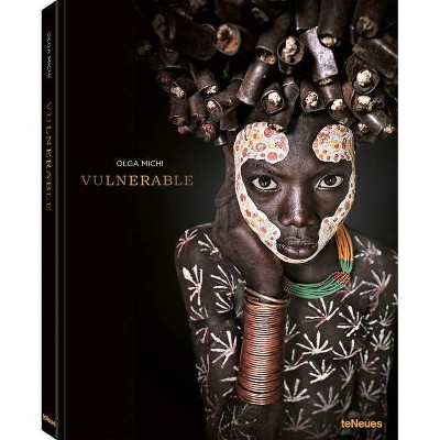 Vulnerable - by  Olga Michi (Hardcover)