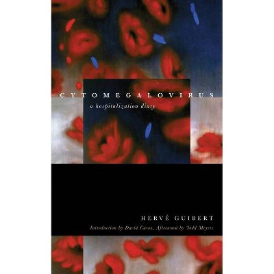 Cytomegalovirus - (Forms of Living) by  Hervé Guibert (Paperback)