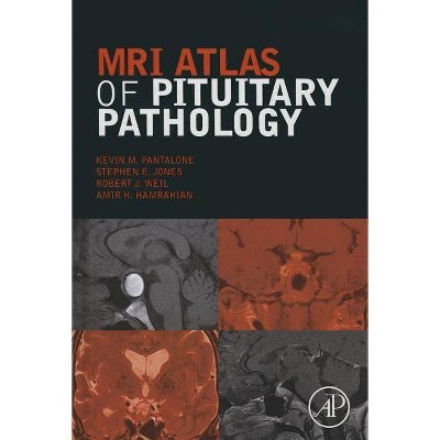 MRI Atlas of Pituitary Pathology - by  Kevin M Pantalone & Stephen E Jones & Robert Weil & Amir H Hamrahian (Hardcover)