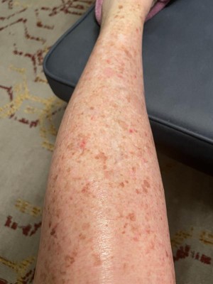 Guest review image 1 of 2, zoom in