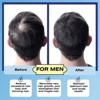 Mediceuticals Cellagen Follicle Revitalizer | Excessive Hair Loss and Thinning Hair|Reduction of Excessive Hair Loss (8.45 oz) - 2 of 3