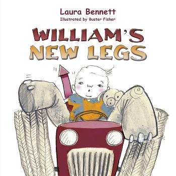 William's New Legs - by  Laura Bennett (Paperback)