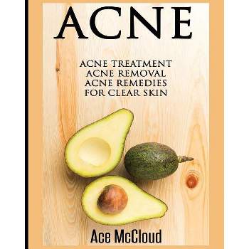 Acne - (Acne Skin Care Treatments from Diet & Medical) by  Ace McCloud (Paperback)