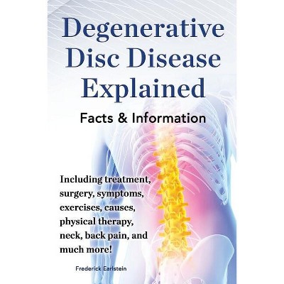 Degenerative Disc Disease Explained. Including Treatment, Surgery, Symptoms,  Exercises, Causes, Physical Therapy, Neck, Back, Pain, And Much More! :  Target