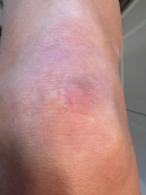 Guest review image 1 of 2, zoom in