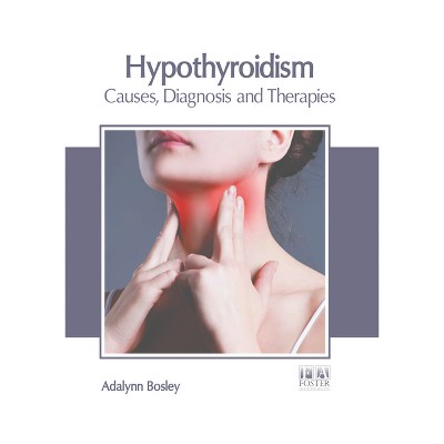 Hypothyroidism: Causes, Diagnosis and Therapies - by  Adalynn Bosley (Hardcover)