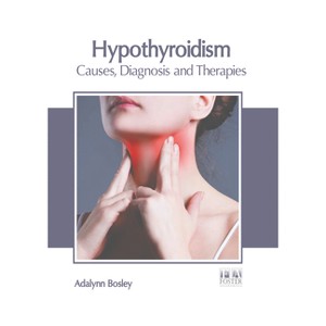 Hypothyroidism: Causes, Diagnosis and Therapies - by  Adalynn Bosley (Hardcover) - 1 of 1