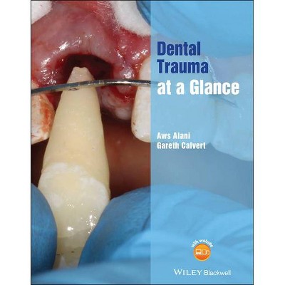 Dental Trauma at a Glance - (At a Glance (Dentistry)) by  Aws Alani & Gareth Calvert (Paperback)