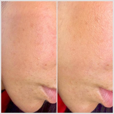 Guest review image 2 of 3, zoom in