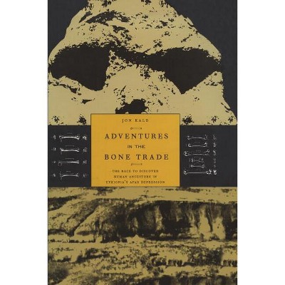 Adventures in the Bone Trade - by  Jon Kalb (Paperback)