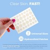 MEDca Hydrocolloid Acne Patches for Face – 36-Count Pimple Spot Bandages in 2 Sizes for Acne, Zits & Blackheads - 2 of 4