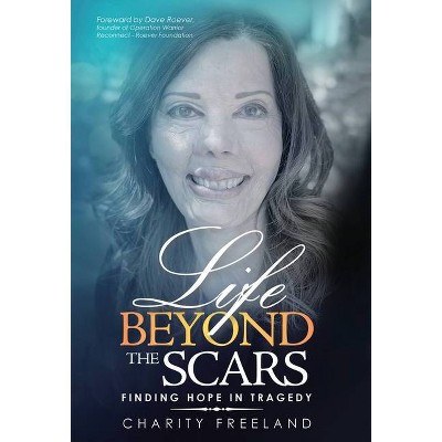 Life Beyond the Scars - by  Charity Freeland (Hardcover)