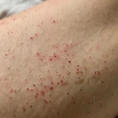 Athena Club Rose Razor Kit : Target