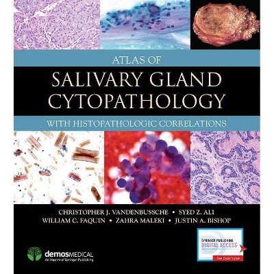 Atlas of Salivary Gland Cytopathology - by  Christopher J Vandenbussche & Syed Z Ali & William C Faquin & Zahra Maleki & Justin Bishop (Hardcover)