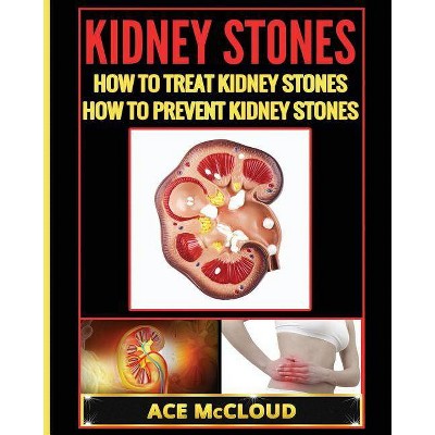 Kidney Stones - (Kidney Stone Treatment & Prevention Guide with All) by  Ace McCloud (Paperback)