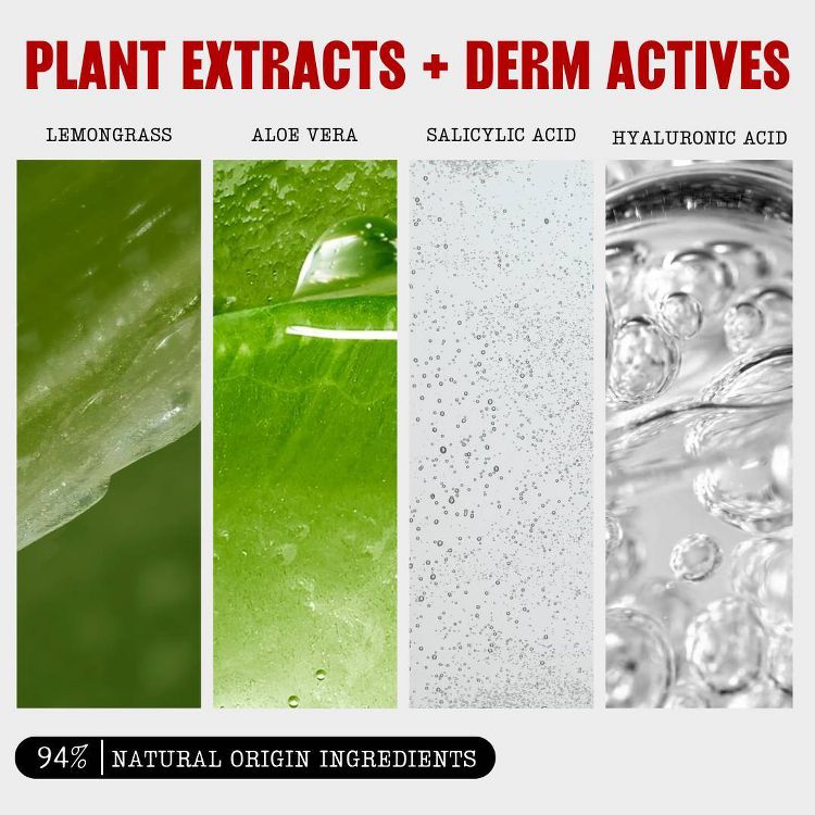 Thayers Natural Remedies Clearing Toner With Salicylic Acid - 12 fl oz, 4 of 9