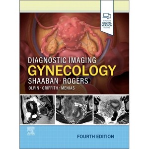 Diagnostic Imaging: Gynecology - 4th Edition by  Akram M Shaaban & Douglas Rogers (Hardcover) - 1 of 1