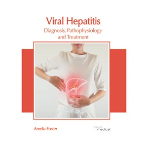 Viral Hepatitis: Diagnosis, Pathophysiology and Treatment - by  Amelia Foster (Hardcover) - 1 of 1