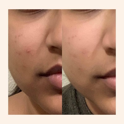 Peach & Lily Glass Skin Refining Serum - 1.35 fl oz - Ulta Beauty: Firming, Brightening, Hydrating, Calming