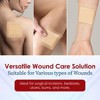 MEDca Silicone Foam Dressing w/ Adhesive Border 4"x4" Pack of 10, Waterproof Highly Absorbent Bandages for Wounds, Bed Sores & Ulcers - 3 of 4