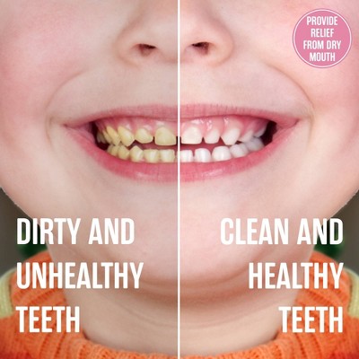 SprinJene Kids Tarter Control Fluoride Toothpaste - Bubblegum - 3.5oz/2ct: Gel, Paraben-Free, Vegan